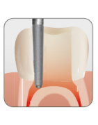Endodontic Safe End